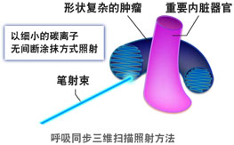 3D scanning irradiation