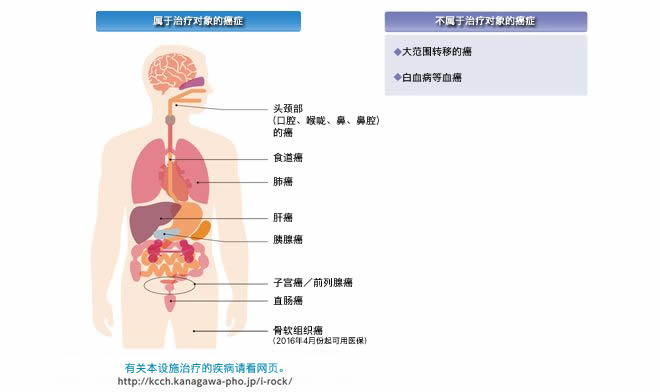 属于治疗对象的癌症/不属于治疗对象的癌症