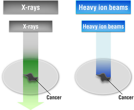 Differences from conventional radiotherapy irradiation