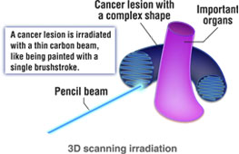 3D scanning irradiation