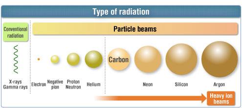 What is heavy ion radiotherapy? | Guide for Heavy Ion Radiotherapy
