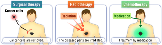 Three methods for treating cancer