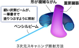 3次元スキャニング照射法