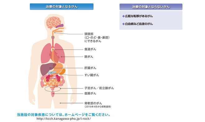 治療の対象となるがん/治療の対象とならないがん